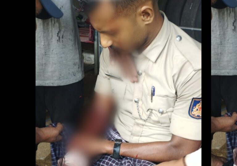 ದೇವರಕೊಲ್ಲಿ : ಅಪಘಾತದಲ್ಲಿ ಗಾಯಗೊಂಡ ಪೋಲಿಸ್ ಸಿಬ್ಬಂದಿ  ಮಂಗಳೂರು ಖಾಸಗಿ ಆಸ್ಪತ್ರೆಗೆ ದಾಖಲು